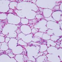 Human lung organoids with a built-in immune system could transform respiratory disease research