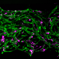 Researchers design bone marrow-on-a-chip model to study human immune cells