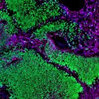 NIH makes major investments to advance human-based research infrastructure and technologies